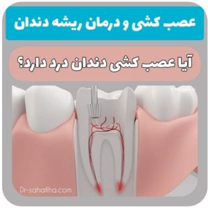 عصب کشی و درمان ریشه دندان